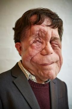 Adam Pearson interpreta The Deformed Man