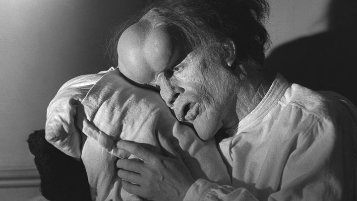 Una scena tratta dal film The Elephant Man